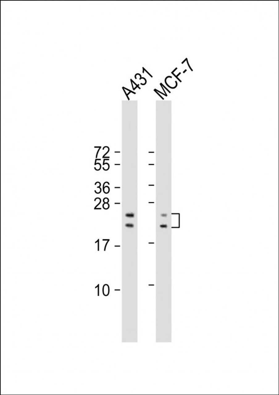 Western Blot at 1:2000 dilution Lane 1: A431 whole cell lysate Lane 2: MCF-7 whole cell lysate Lysates/proteins at 20 ug per lane.