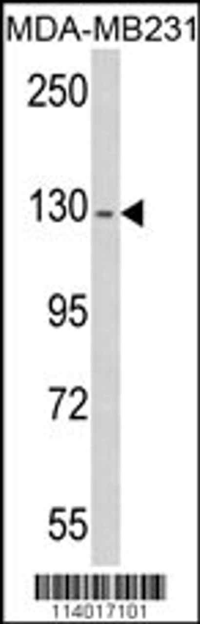 Western blot analysis of RASGRF1 antibody (S929) in MDA-MB231 cell line lysates (35ug/lane)