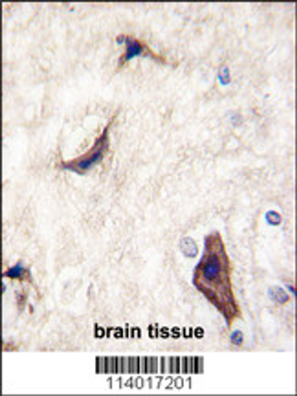 Formalin-fixed and paraffin-embedded human brain tissue reacted with RASGRF1 Antibody (S929) , which was peroxidase-conjugated to the secondary antibody, followed by DAB staining.