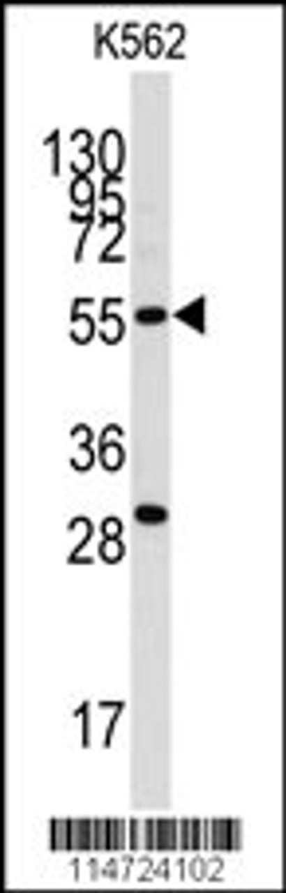 Western blot analysis of anti-CLIC5 Antibody in K562 cell line lysates (35ug/lane) .