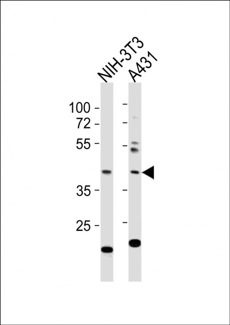 Western Blot at 1:1000 dilution Lane 1: NIH-3T3 whole cell lysates Lane 2: A431 whole cell lysates Lysates/proteins at 20 ug per lane.