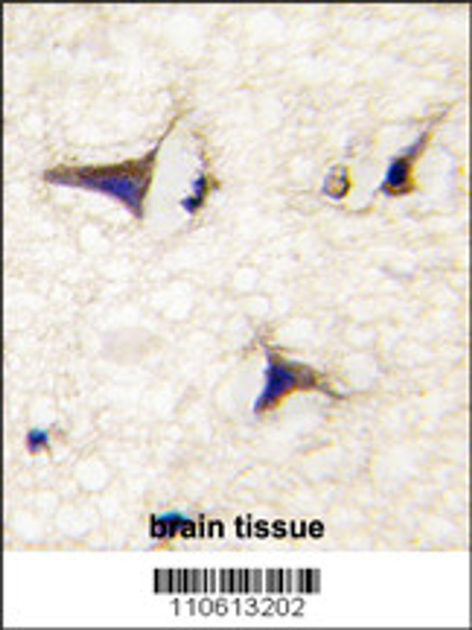 Formalin-fixed and paraffin-embedded human brain tissue reacted with DAAM2 Antibody, which was peroxidase-conjugated to the secondary antibody, followed by DAB staining.