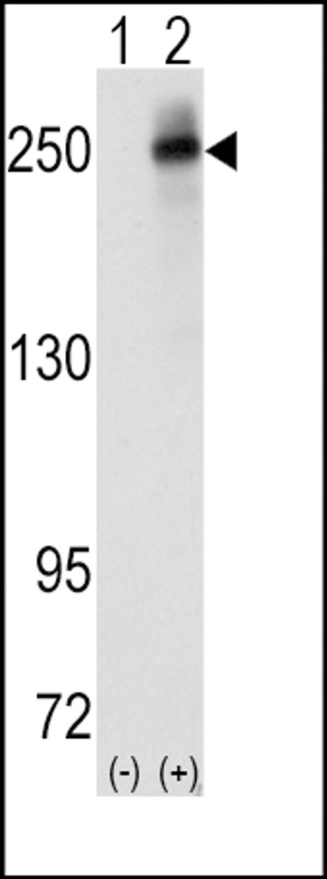 Western blot analysis of ALK using rabbit polyclonal ALK Antibody.293 cell lysates (2 ug/lane) either nontransfected (Lane 1) or transiently transfected with the ALK gene (Lane 2) .
