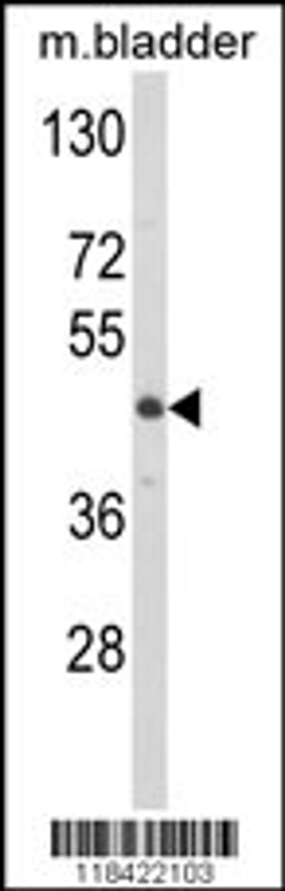 Western blot analysis of LUM Antibody in mouse bladder tissue lysates (35ug/lane)