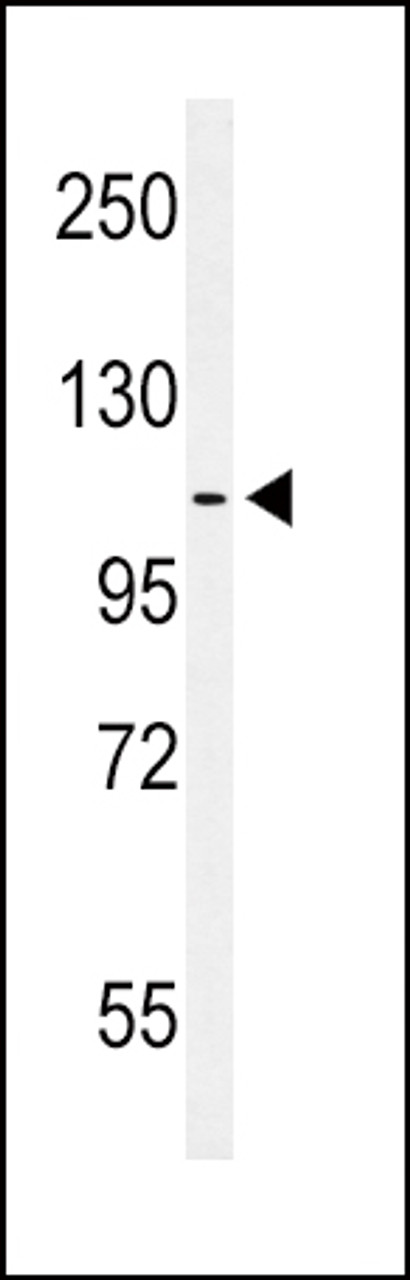 Western blot analysis of hEPHA2-T45 in MCF-7 cell line lysates (35ug/lane)