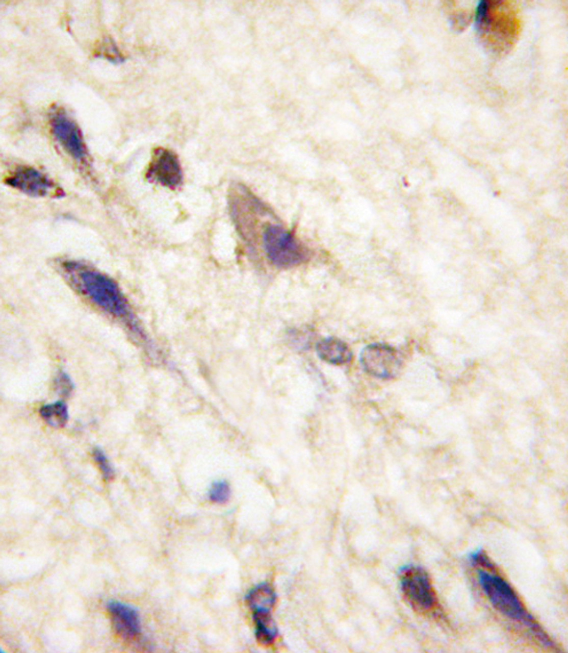 Formalin-fixed and paraffin-embedded human brain tissue reacted with EphA5 antibody (N-term ) , which was peroxidase-conjugated to the secondary antibody, followed by DAB staining.