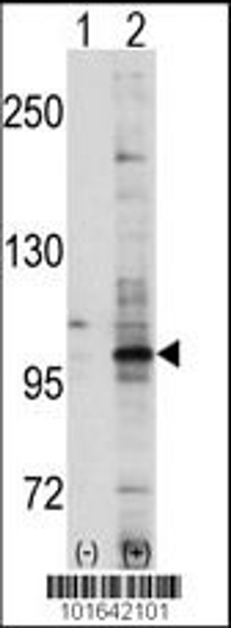 Western blot analysis of EPHA7 using EphA7 Antibody using 293 cell lysates (2 ug/lane) either nontransfected (Lane 1) or transiently transfected with the EPHA7 gene (Lane 2) .