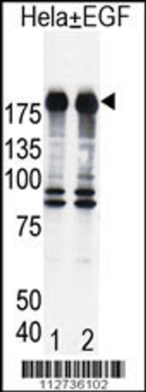Western blot analysis of EGFR in Hela cell lysates, either induced (Lane 1) or noninduced with EGF (Lane 2) .