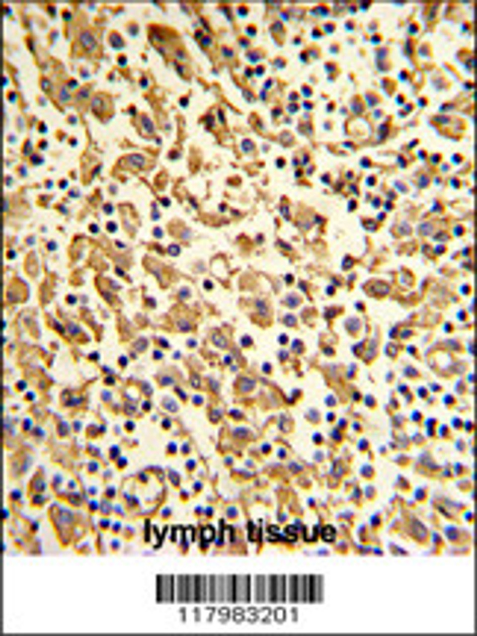 Formalin-fixed and paraffin-embedded human lymph with XPOT Antibody (N-term) , which was peroxidase-conjugated to the secondary antibody, followed by DAB staining.