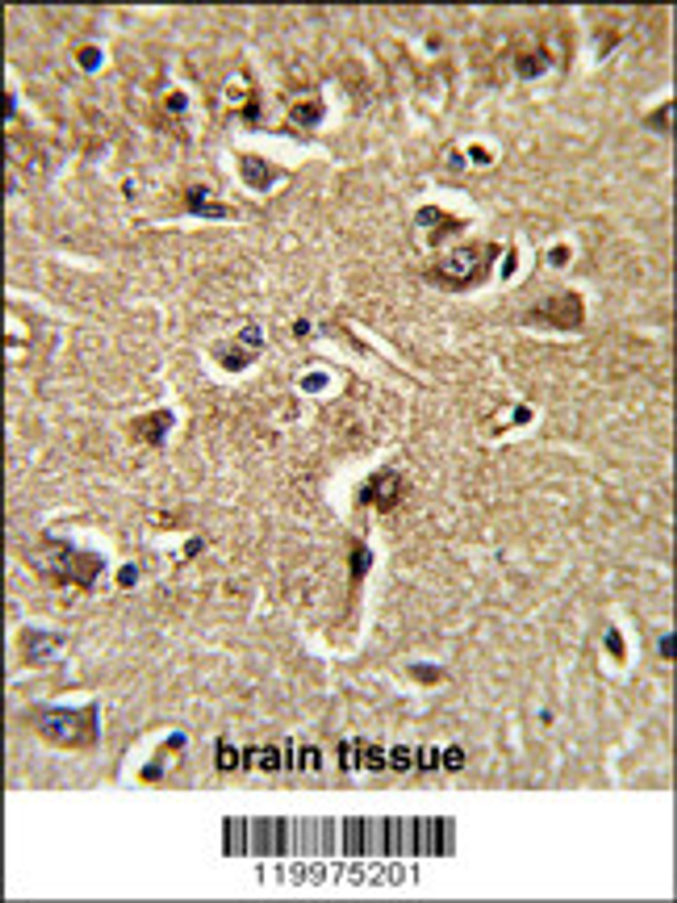 Formalin-fixed and paraffin-embedded human brain tissue reacted with XPOT Antibody, which was peroxidase-conjugated to the secondary antibody, followed by DAB staining.