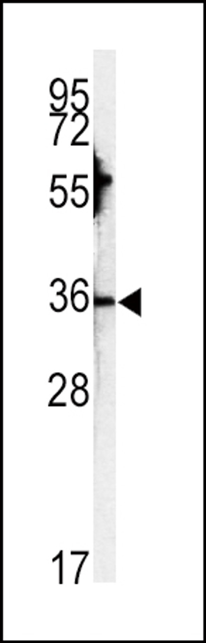 Western blot analysis of CA3 antibody in HepG2 cell line lysates (35ug/lane)