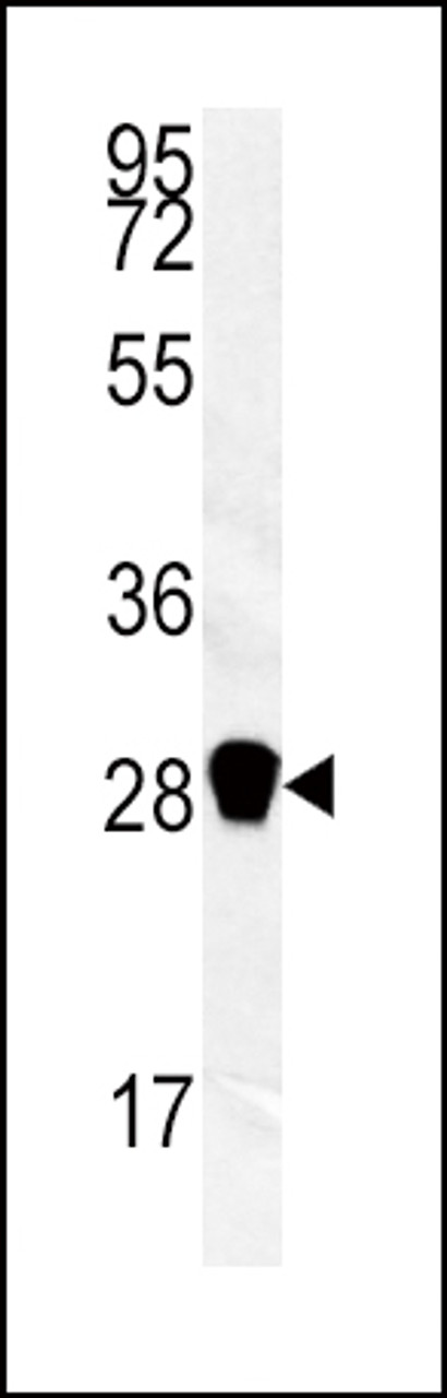 Western blot analysis of CA3 antibody in mouse kidney tissue lysates (35ug/lane)