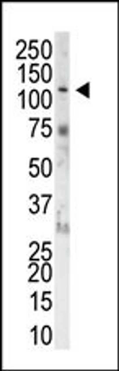 Antibody is used in Western blot to detect FGFR1 in NIH-3T3 cell lysate.
