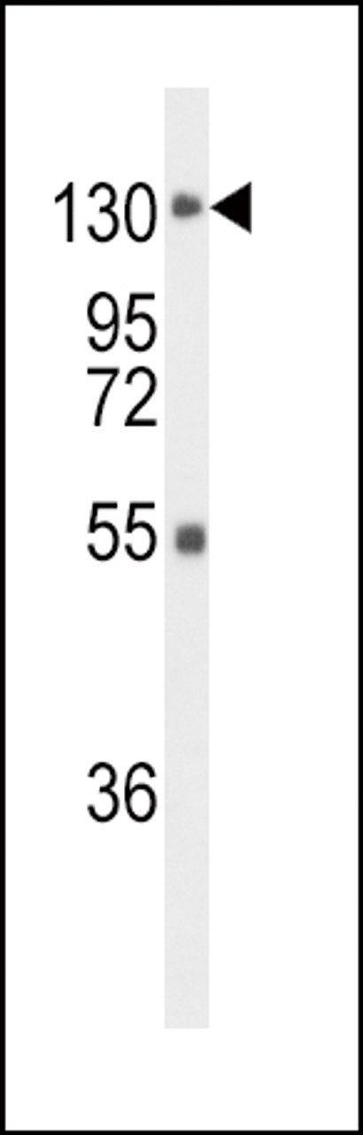 Western blot analysis of FGFR1 Antibody in mouse liver tissue lysates (35ug/lane)