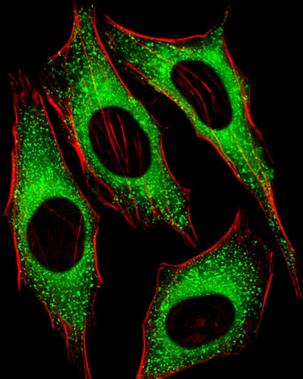 Fluorescent image of Hela cells stained with FGFR2 Antibody (N-term) . Antibody was diluted at 1:25 dilution. An Alexa Fluor 488-conjugated goat anti-rabbit lgG at 1:400 dilution was used as the secondary antibody (green) . Cytoplasmic actin was counterstained with Alexa Fluor 555 conjugated with Phalloidin (red) .