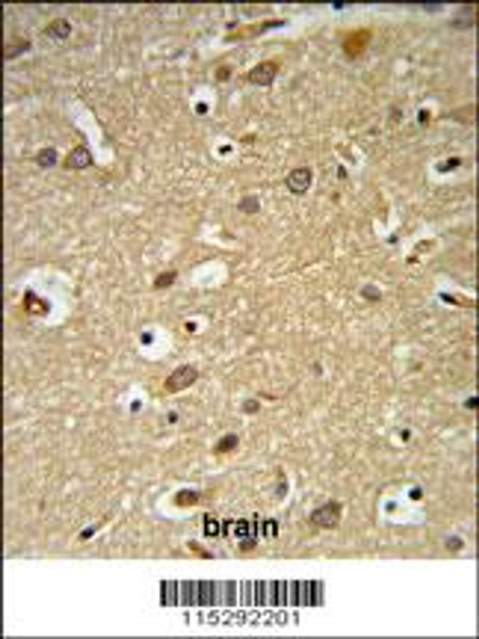 IGF1R Antibody (N-term K66) IHC analysis in formalin fixed and paraffin embedded brain tissue followed by peroxidase conjugation of the secondary antibody and DAB staining. This data demonstrates the use of the IGF1R Antibody (N-term K66) for immunohistochemistry.
