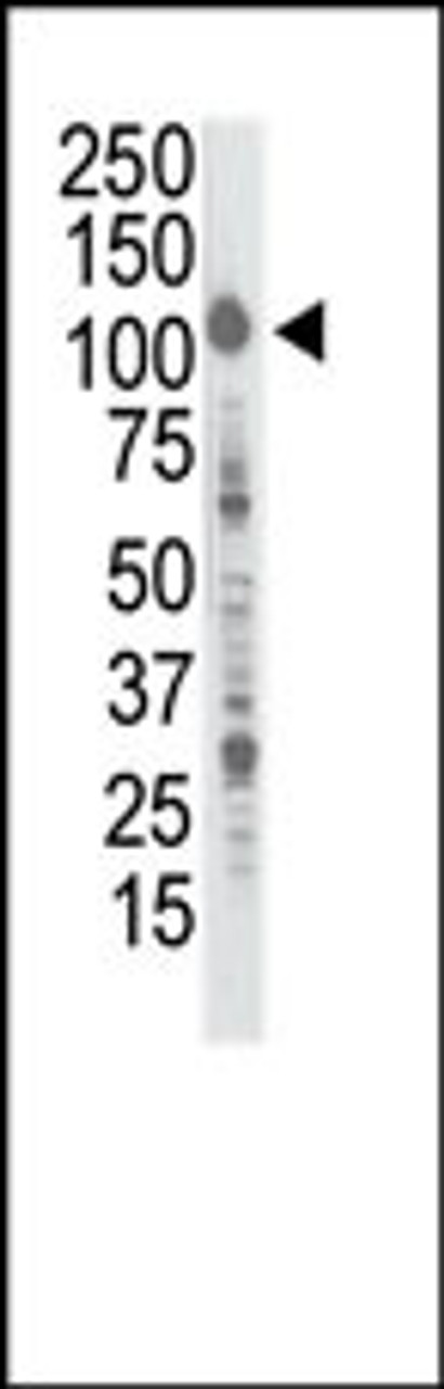 Western blot analysis of anti-InsRR Pab in A375 cell lysate. Lane A: preimmune, Lane B: purified antibody