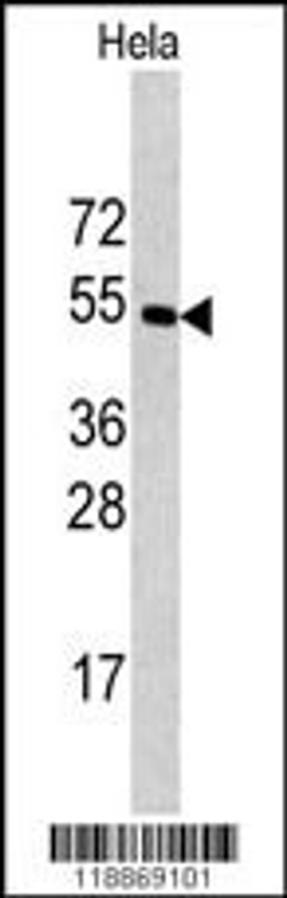 Western blot analysis of CPE antibody in Hela cell line lysates (35ug/lane)