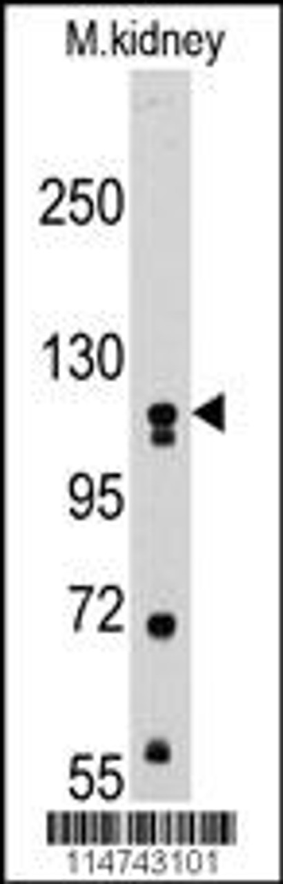 Western blot analysis of anti-MUSK Pab in mouse kidney tissue lysates (35ug/lane)