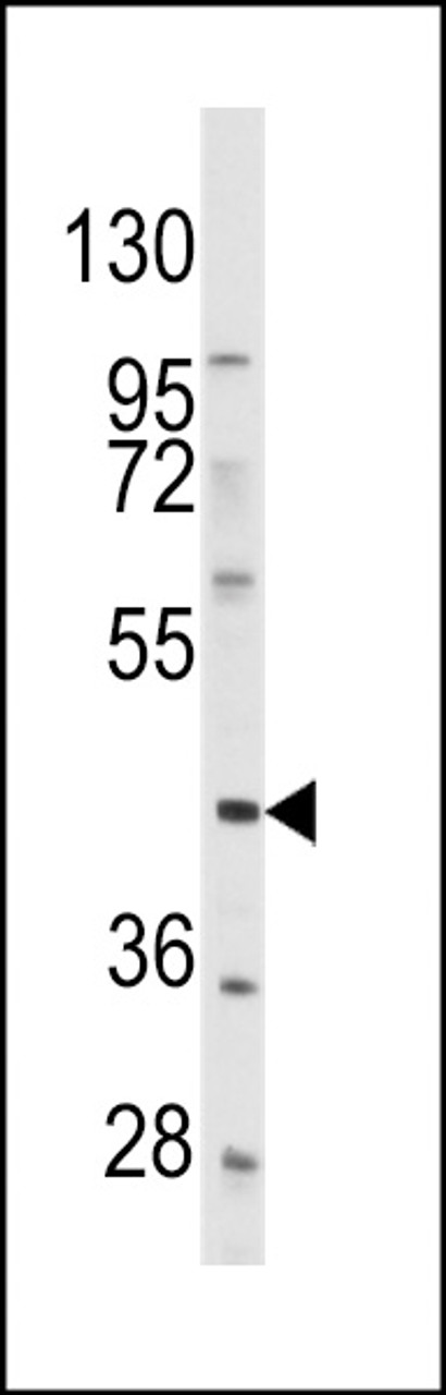Western blot analysis of anti-PDGFRL Antibody in Hela cell line lysates (35ug/lane) .