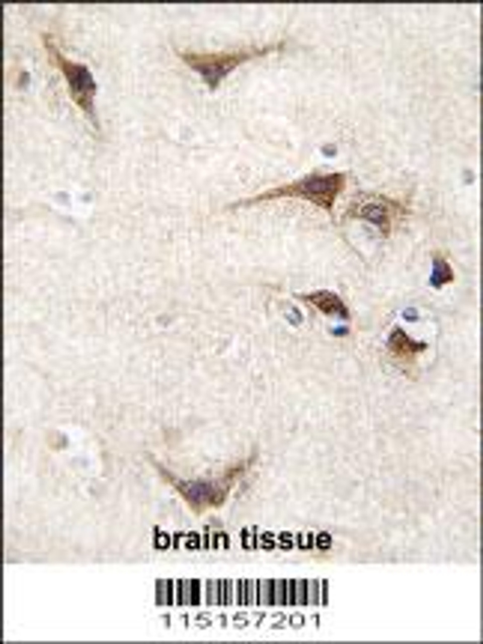 Formalin-fixed and paraffin-embedded human brain tissue reacted with TYRO3 antibody, which was peroxidase-conjugated to the secondary antibody, followed by DAB staining.