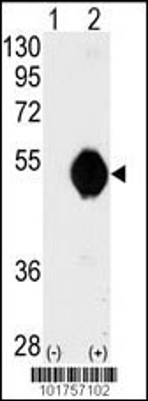 Western blot analysis of DOK2 using DOK2 Antibody using 293 cell lysates (2 ug/lane) either nontransfected (Lane 1) or transiently transfected with the DOK2 gene (Lane 2) .