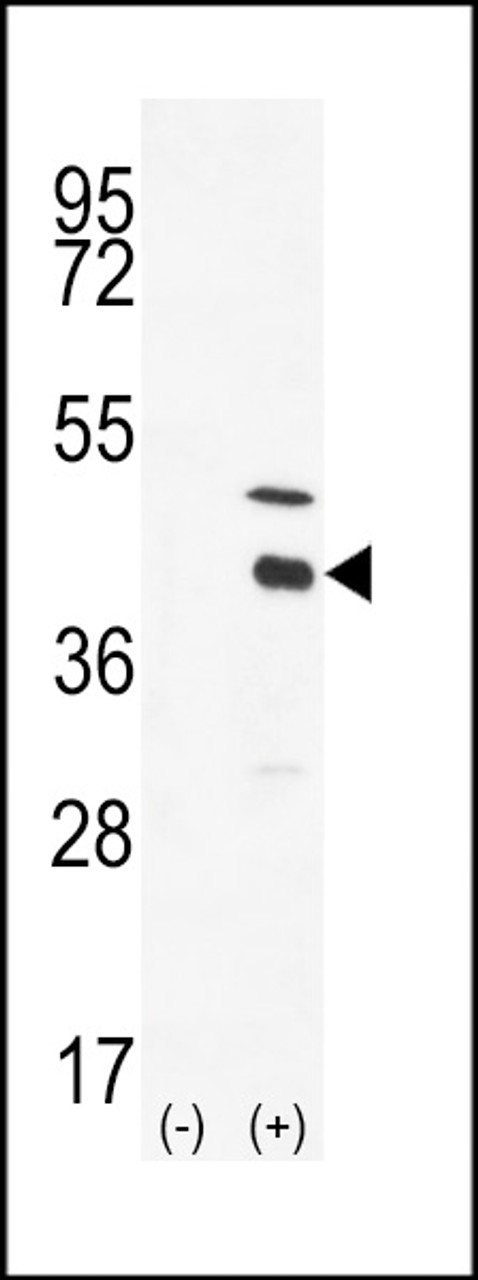 Western blot analysis of DOK4 using DOK4 Antibody using 293 cell lysates (2 ug/lane) either nontransfected (Lane 1) or transiently transfected with the DOK4 gene (Lane 2) .