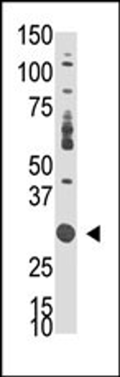 Antibody is used in Western blot to detect DOK5 in mouse liver tissue lysate.