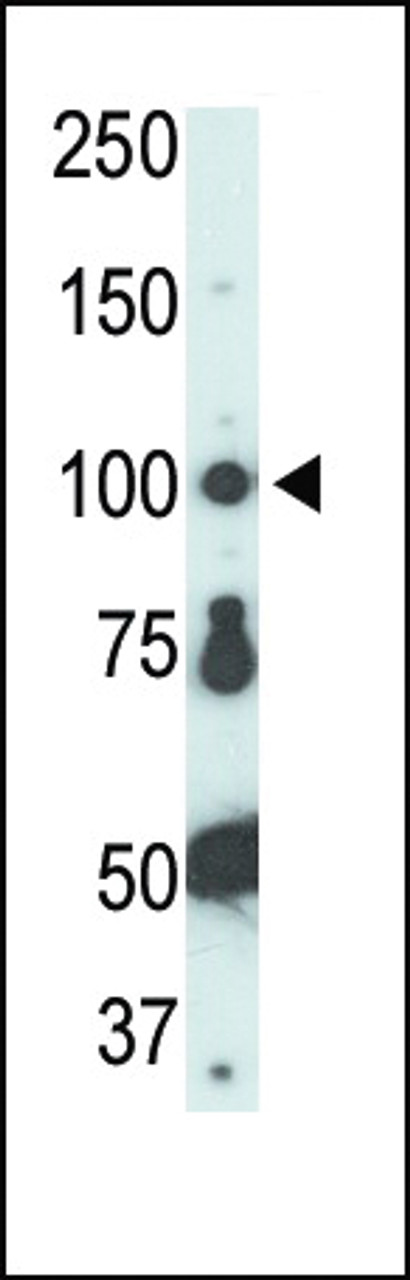 Antibody is used in Western blot to detect FER in HL-60 cell lysate.