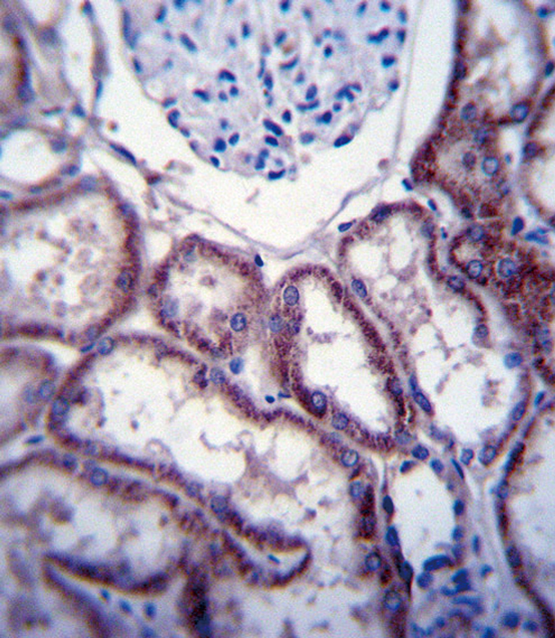 FER Antibody immunohistochemistry analysis in formalin fixed and paraffin embedded human kidney tissue followed by peroxidase conjugation of the secondary antibody and DAB staining.