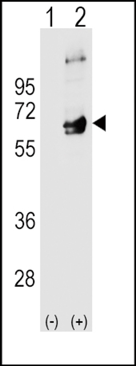 Western blot analysis of FYN using rabbit polyclonal FYN Antibody using 293 cell lysates (2 ug/lane) either nontransfected (Lane 1) or transiently transfected (Lane 2) with the FYN gene.