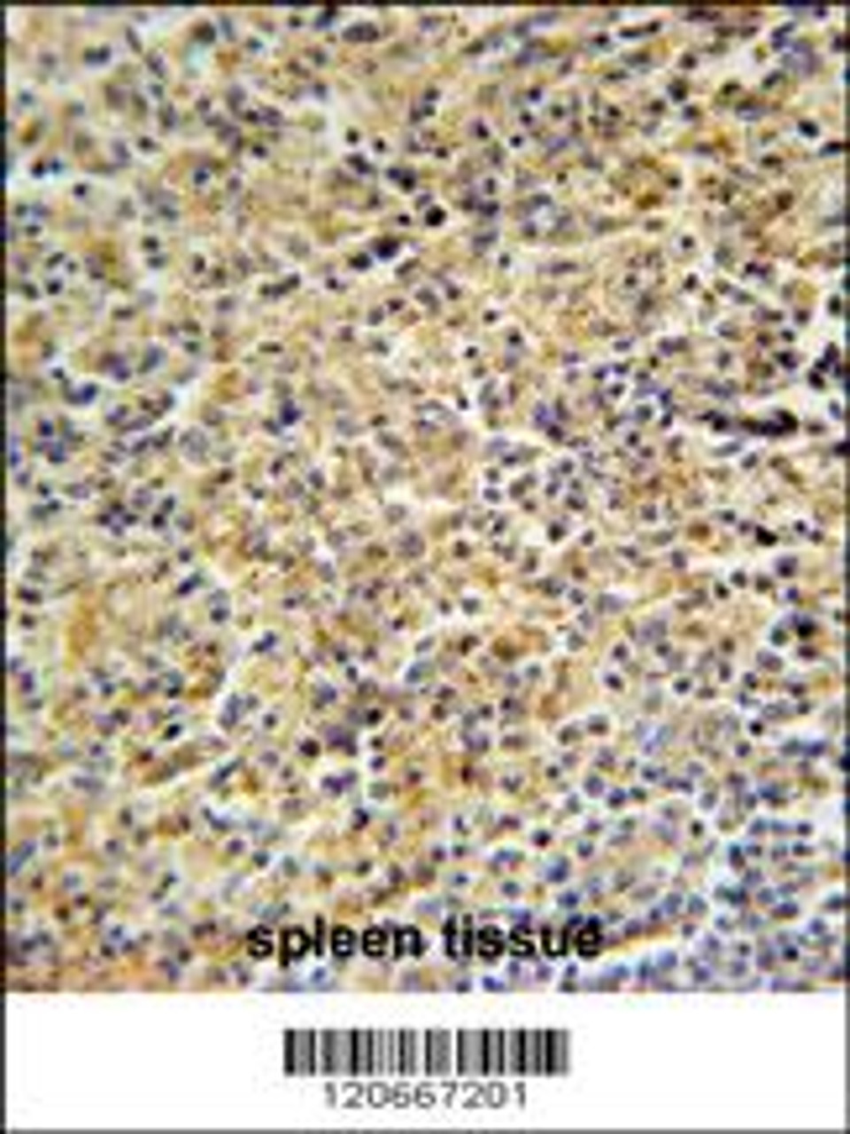 HCK Antibody immunohistochemistry analysis in formalin fixed and paraffin embedded human spleen tissue followed by peroxidase conjugation of the secondary antibody and DAB staining.