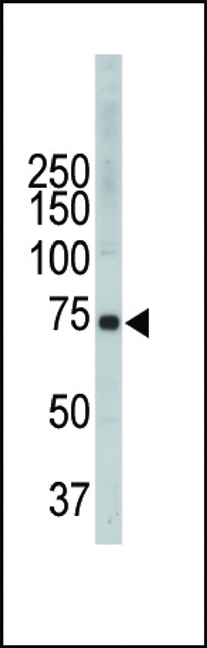 Antibody is used in Western blot to detect ITK in CEM cell lysate.