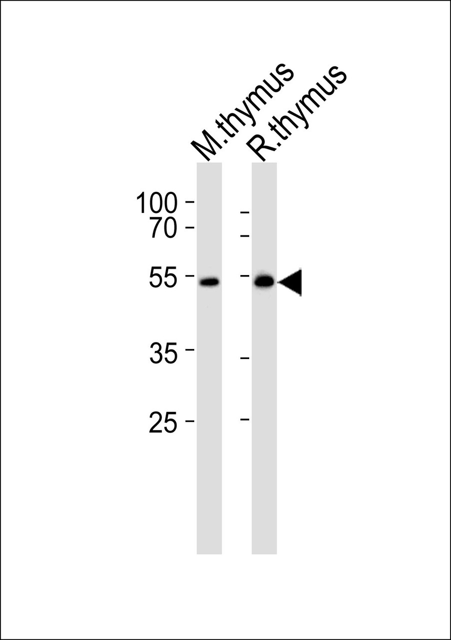 Western blot analysis of lysates from mouse thymus and rat thymus tissue lysate (from left to right) , using LSK Antibody (I37) at 1:1000 at each lane.