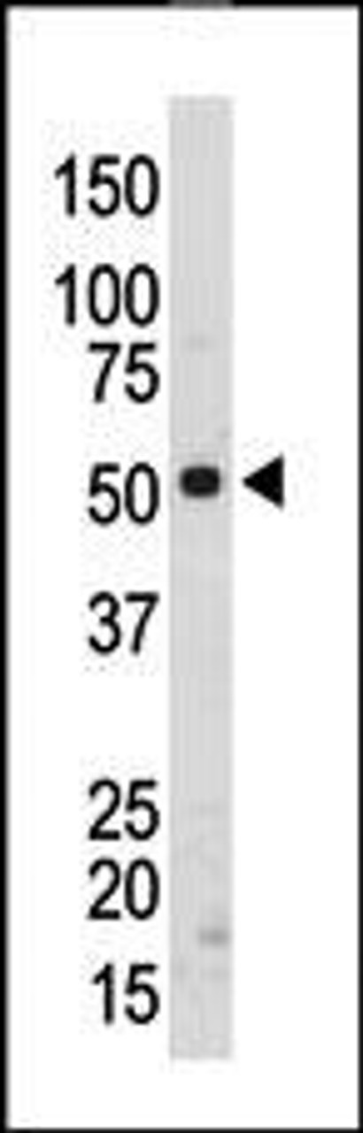 Antibody is used in Western blot to detect SRMS in mouse kidney tissue lysate.