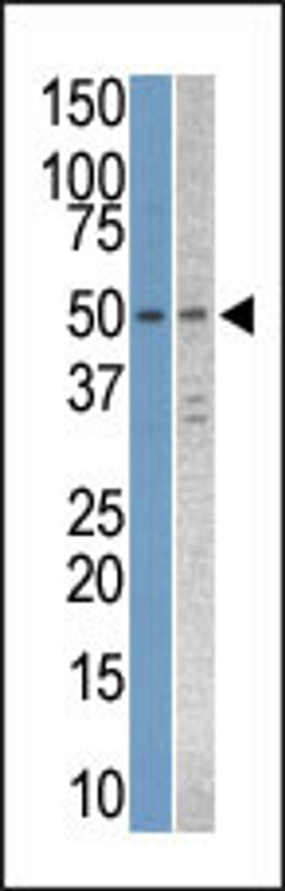 Antibody is used in Western blot to detect STK38L in Jurkat and T47D cell line lysates.
