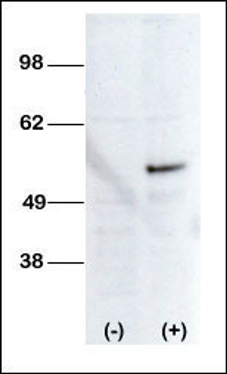 Western blot analysis of anti-STK38L Pab transiently transfected HEK-293 cell line lysate (1ug/lane) .