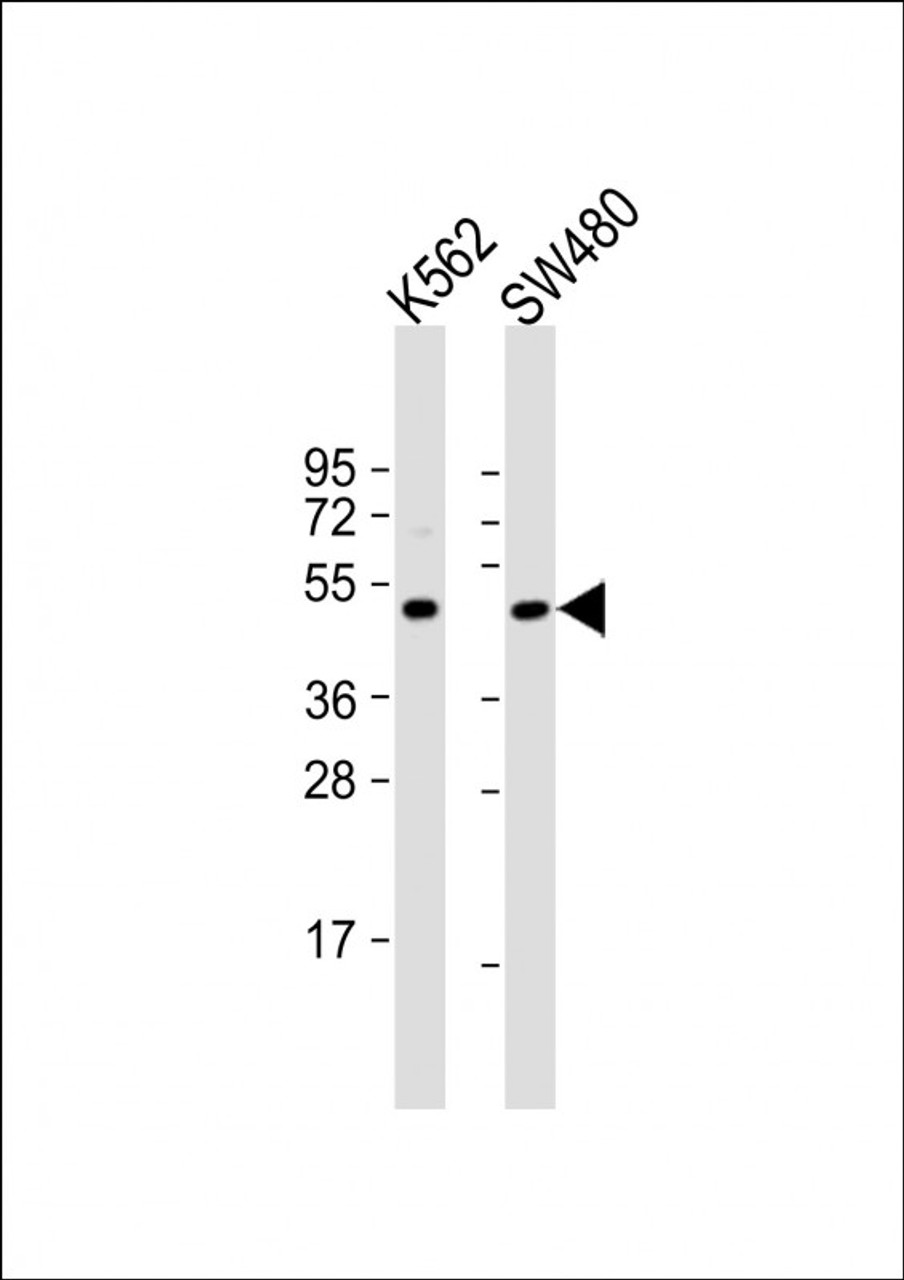 Western Blot at 1:1000 dilution Lane 1: K562 whole cell lysate Lane 2: SW480 whole cell lysate Lysates/proteins at 20 ug per lane.