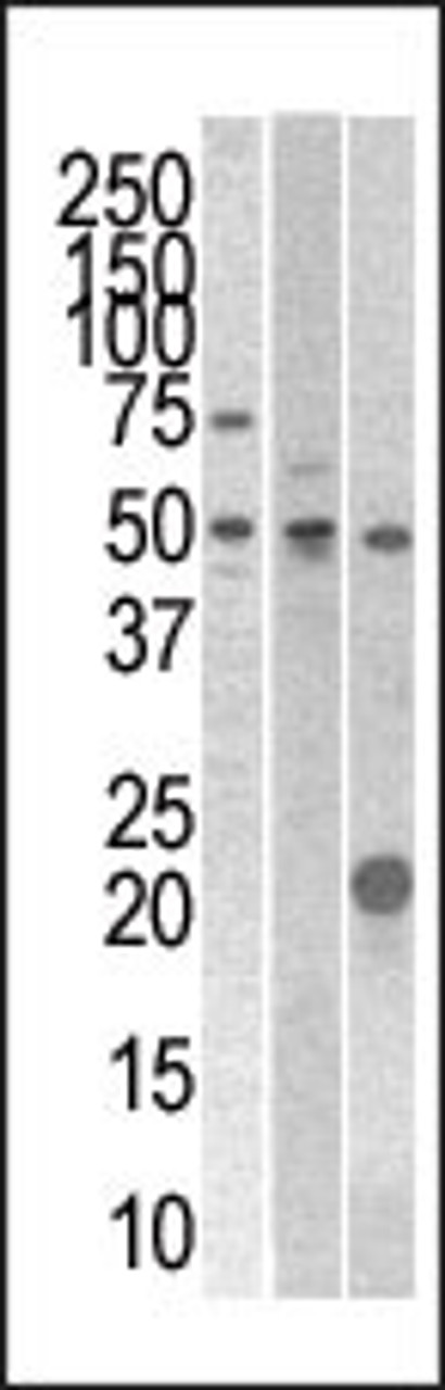 Antibody is used in Western blot to detect STYK1 in 293, CEM, and mouse kidney cell line/tissue lysates.