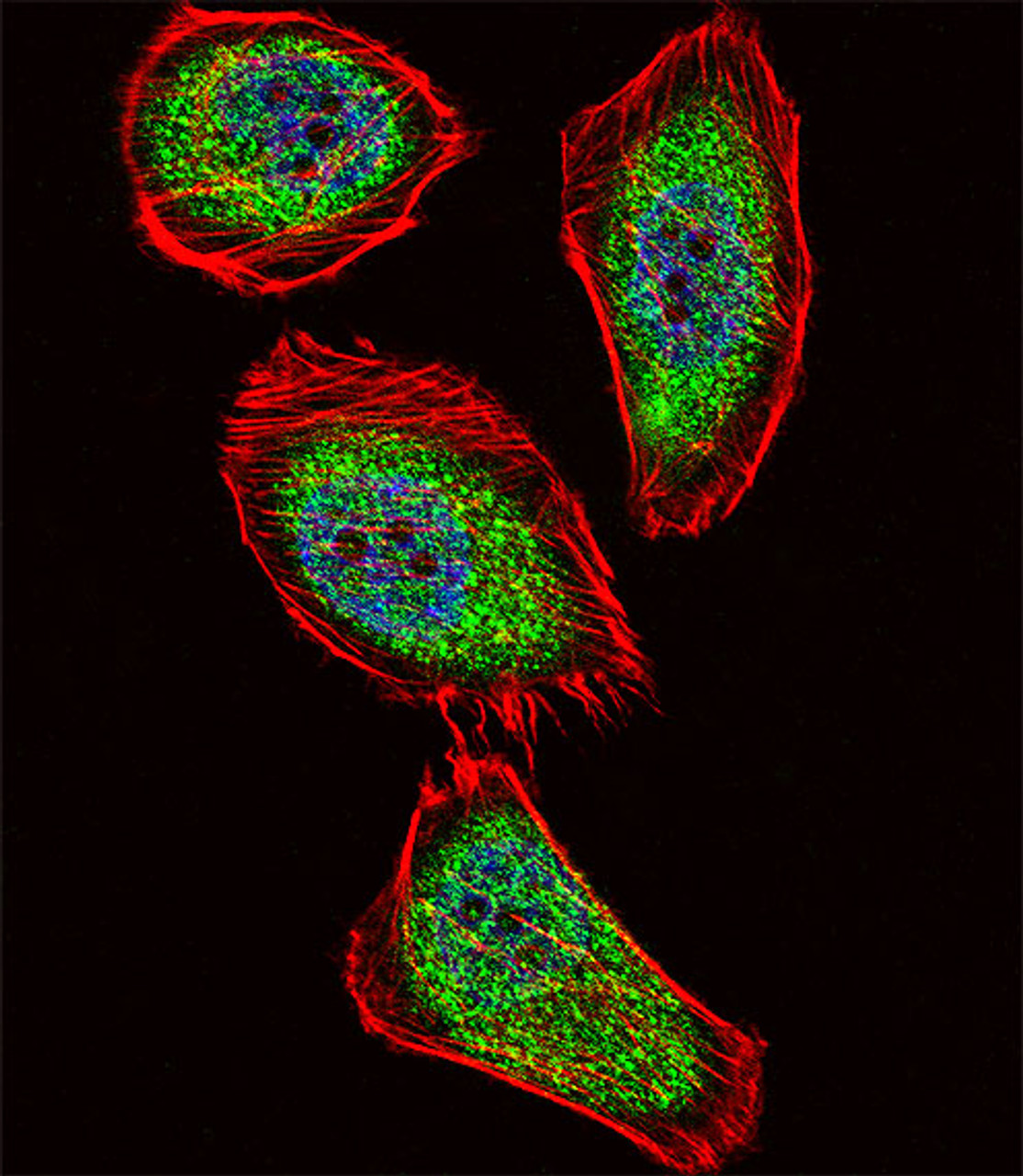Fluorescent confocal image of U251 cell stained with IPF Antibody .U251 cells were fixed with 4% PFA (20 min) , permeabilized with Triton X-100 (0.1%, 10 min) , then incubated with IPF primary antibody (1:25) . For secondary antibody, Alexa Fluor 488 conjugated donkey anti-rabbit antibody (green) was used (1:400) .Cytoplasmic actin was counterstained with Alexa Fluor 555 (red) conjugated Phalloidin (7units/ml) . Nuclei were counterstained with DAPI (blue) (10 ug/ml, 10 min) . IPF immunoreactivity is localized to Cytoplasm and Nucleus significantly.
