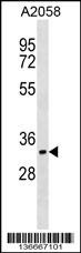 Western blot analysis in A2058 cell line lysates (35ug/lane) .