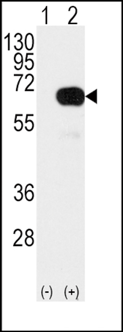 Western blot analysis of SMAD4 Antibody (T277) using rabbit polyclonal SMAD4 Antibody (T277) using 293 cell lysates (2 ug/lane) either nontransfected (Lane 1) or transiently transfected with the SMAD4 gene (Lane 2) .