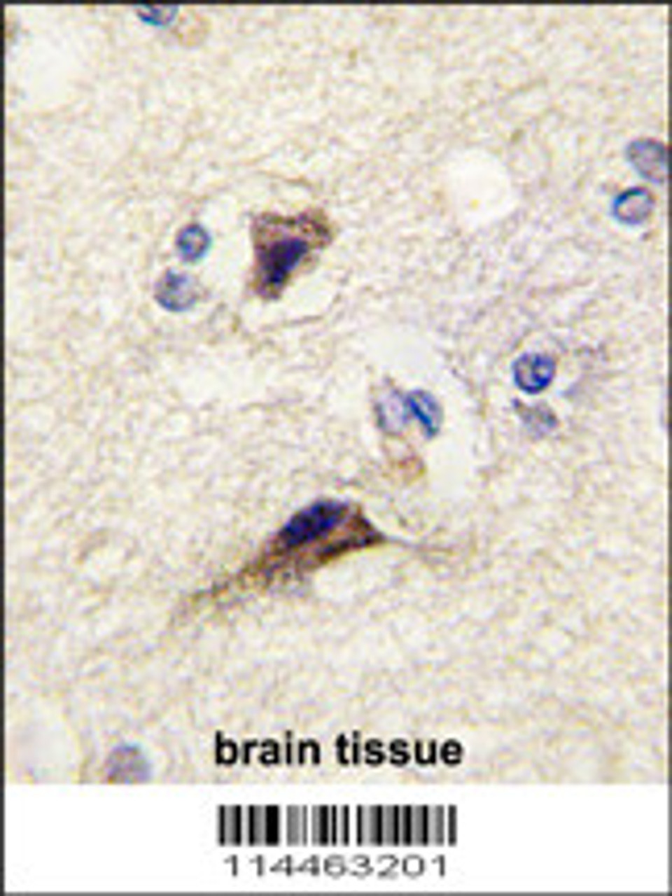 Formalin-fixed and paraffin-embedded human brain tissue reacted with NTF3 antibody, which was peroxidase-conjugated to the secondary antibody, followed by DAB staining.