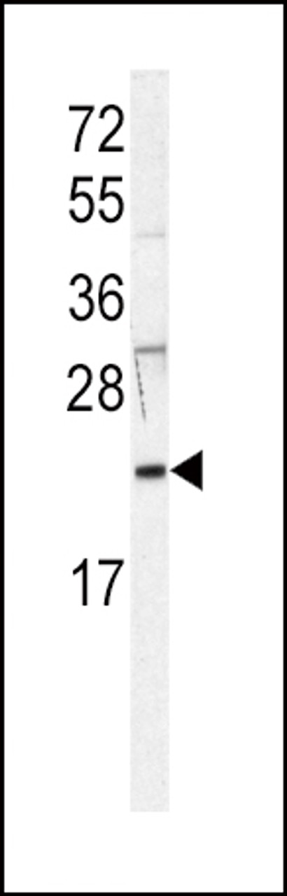 Western blot analysis of anti-HRAS Antibody in Jurkat cell line lysates (35ug/lane)