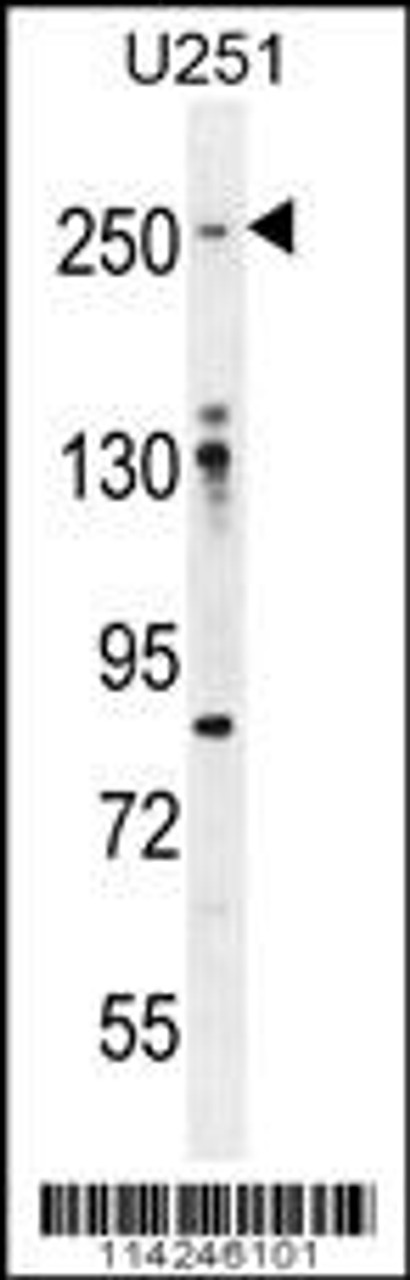 Western blot analysis in U251 cell line lysates (35ug/lane) .This demonstrates the FLNA antibody detected the FLNA protein (arrow) .