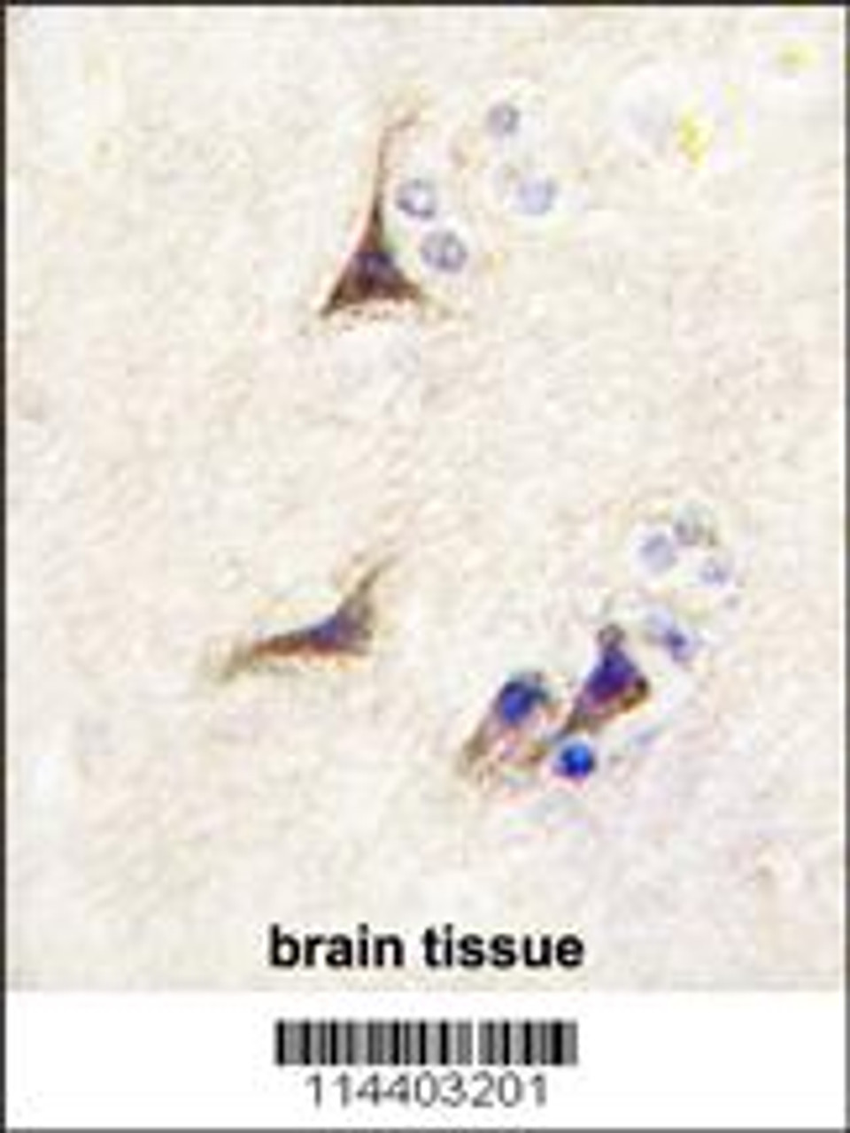 Formalin-fixed and paraffin-embedded human brain tissue reacted with NGFB antibody, which was peroxidase-conjugated to the secondary antibody, followed by DAB staining.
