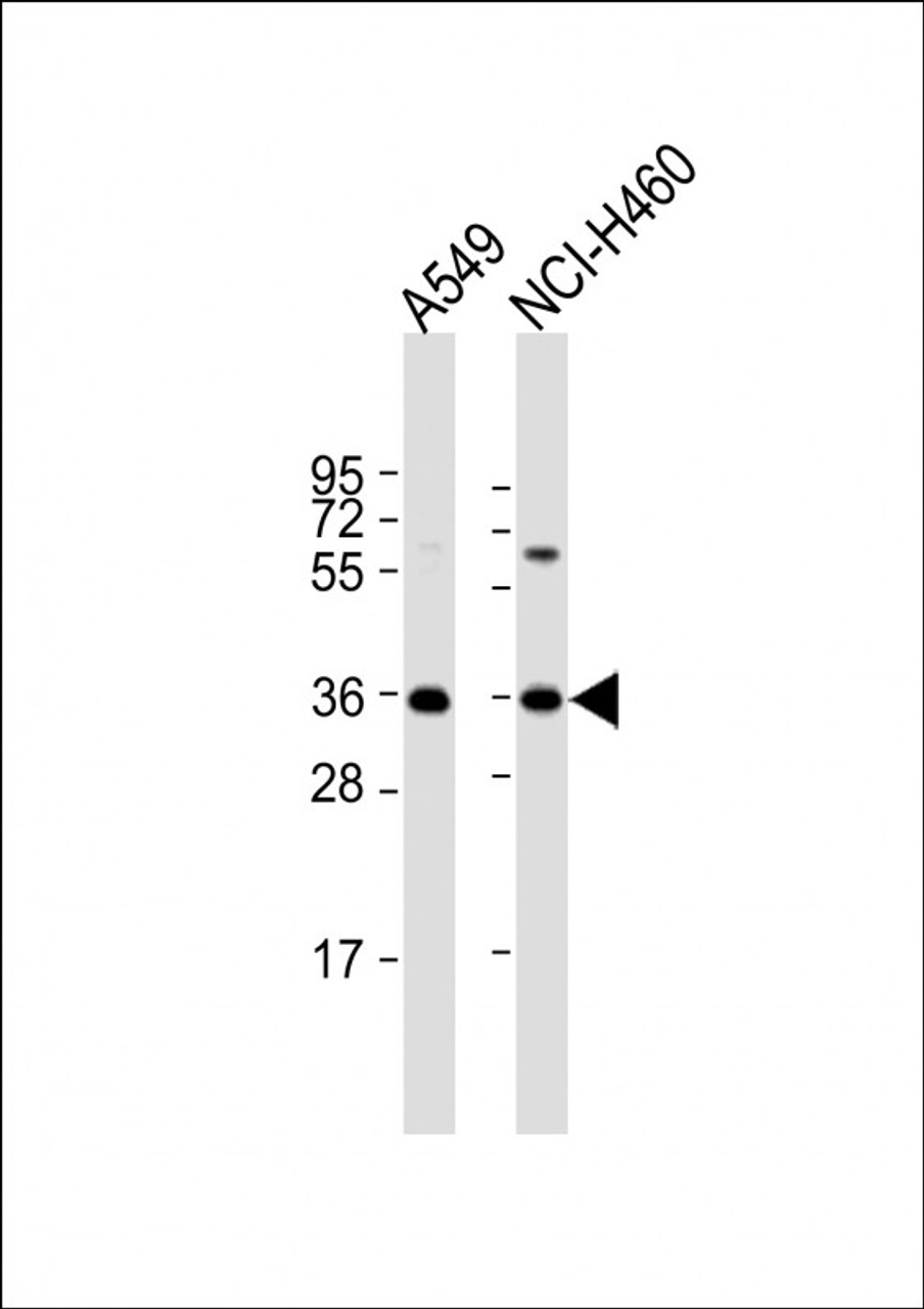 Western Blot at 1:1000 dilution Lane 1: A549 whole cell lysate Lane 2: NCI-H460 whole cell lysate Lysates/proteins at 20 ug per lane.