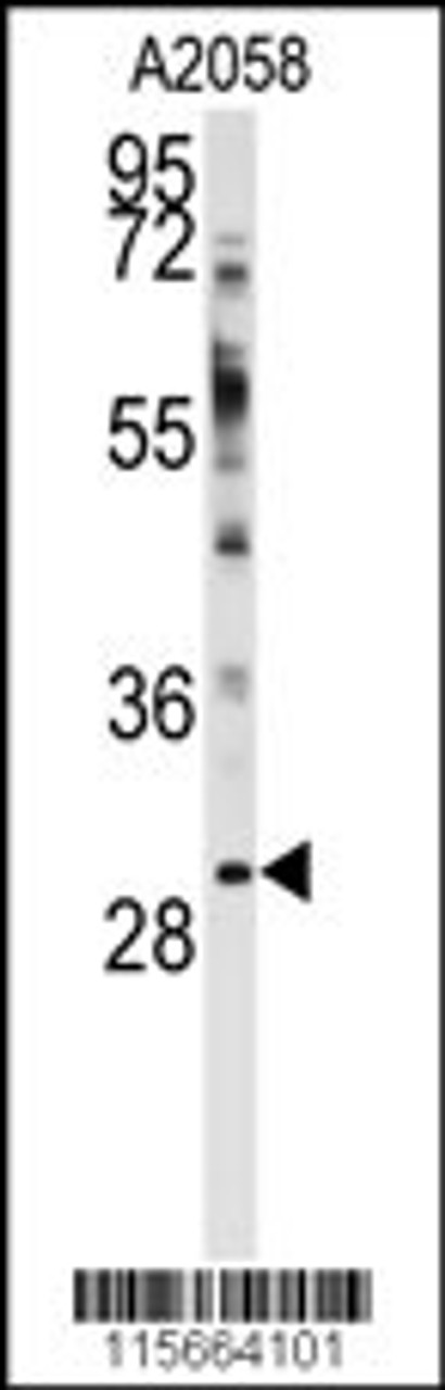 Western blot analysis of anti-WBP2 Antibody in A2058 cell line lysates (35ug/lane)