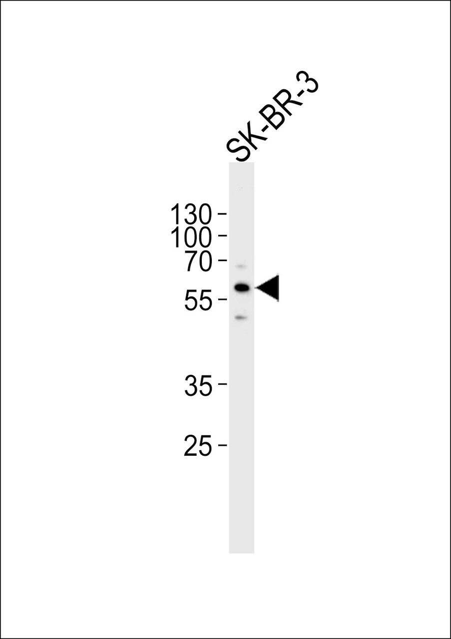 Western blot analysis of lysate from SK-BR-3 cell line, using CYP3A5 Antibody at 1:1000.