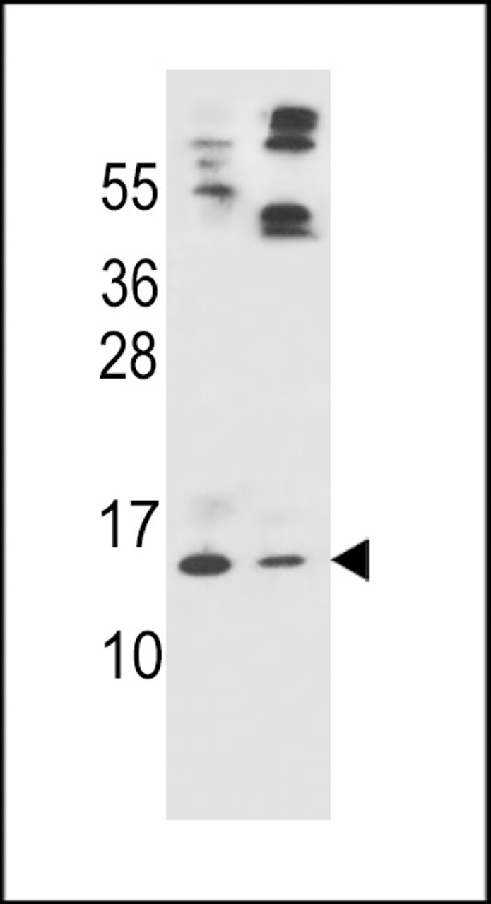 Western blot analysis in HL-60 (lane 1) , A549 (lane 2) cell line lysates (35ug/lane) .